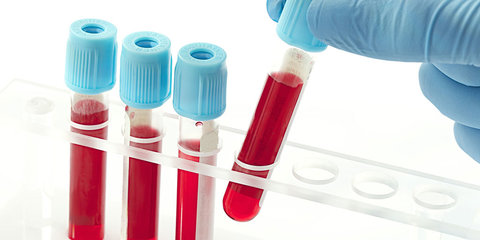 راه اندازی بانک اطلاعات سلولی گامی موثر در درمان بیماری‌های صعب العلاج