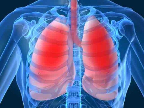 بیش از ۳۲۰ میلیون نفر در جهان مبتلا به آسم هستند