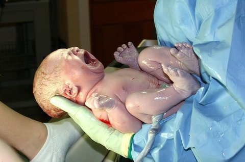 ۱۰ درصد مرگ و میر دوران نوزادی مربوط به بیماری های قلبی مادرزادی است