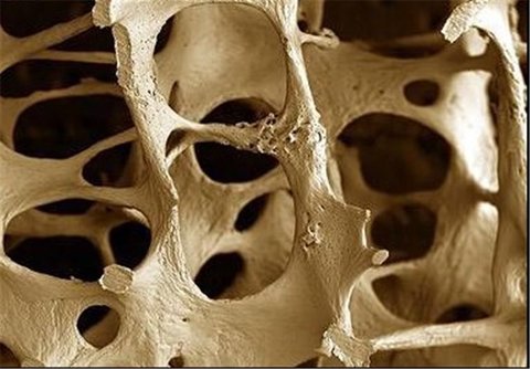 رونمایی از استخوان مصنوعی تولید شده با پرینتر سه بعدی در کشور