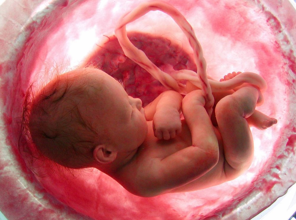 سقط ۱۰۰۰ جنین در روز