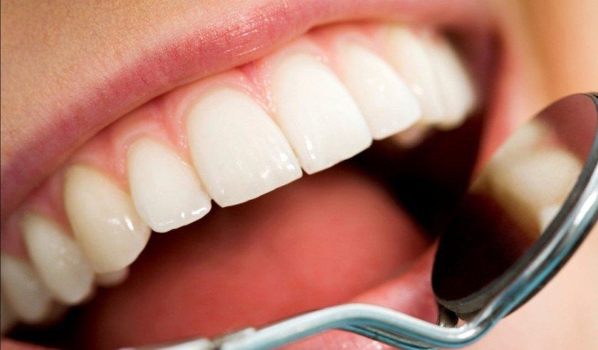 درمان حساسیت دندان ها با عصاره "چای سبز"