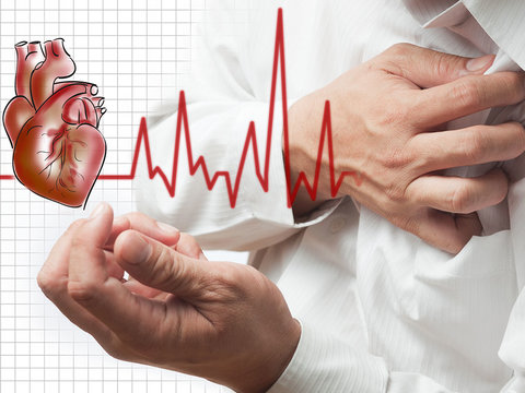 ۸۰ درصد سکته های قلبی قابل پیشگیری هستند