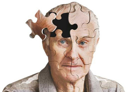 سن ابتلا به آلزایمر در زنان و مردان متفاوت است