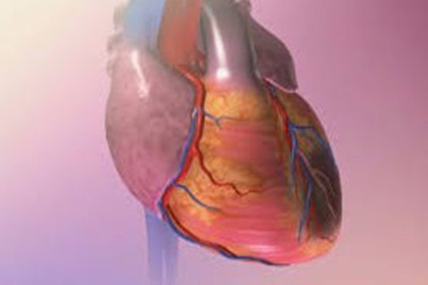 تجمع مایع در اطراف قلب عامل نارسایی قلب / همیشه نیاز به تخلیه آب نیست
