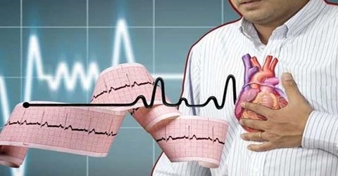 سن بروز بیماری های قلبی عروقی در ایران ۱۰ سال پایین تر از متوسط جهانی است