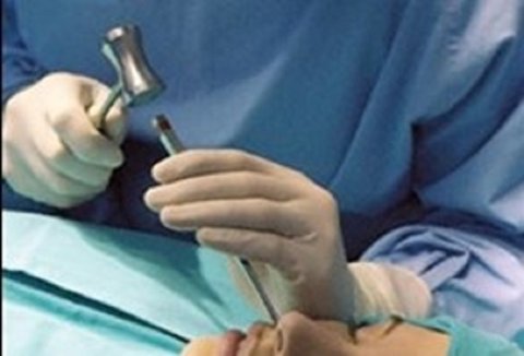 ارائه جدیدترین روش‌های جراحی زیبایی در کنگره بین المللی جراحی پلاستیک اصفهان
