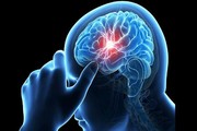 زنگ خطر سکته مغزی را جدی بگیرید