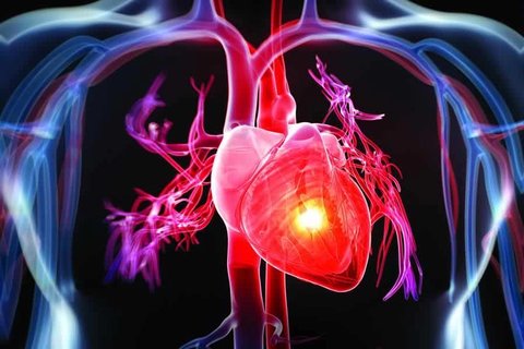 ساخت استنت‌های زیست تخریب‌پذیر برای رگ‌های قلبی