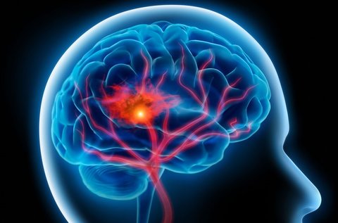 چه افرادی بیشتر در معرض  ابتلا به سرطان مغز قرار دارند؟
