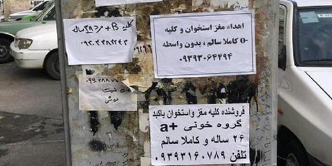 تبلیغ کلیه‌ فروشی روی دیوار واقعی و مجازی/کلیه بنگاه اقتصادی امروز