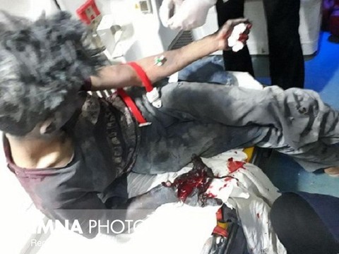 سوختگی دست و پا بیشترین آسیب حوادث چهارشنبه سوری است