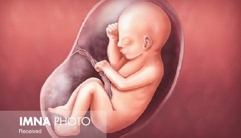 چند جنین مادر مبتلا به تالاسمی در اصفهان سقط می‌شود؟