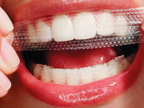 ۱۰ سال ‌عمر مفید ایمپلنت ‌های دندانی/خطر مصرف روزانه نوشابه