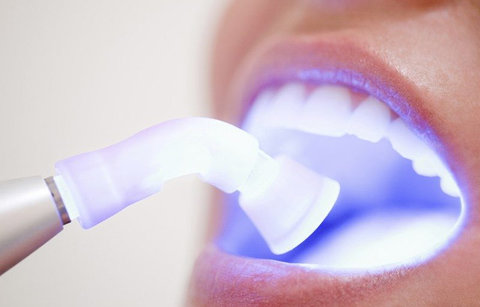 دندان‌ها را به مواد سفیدکننده عادت ندهیم