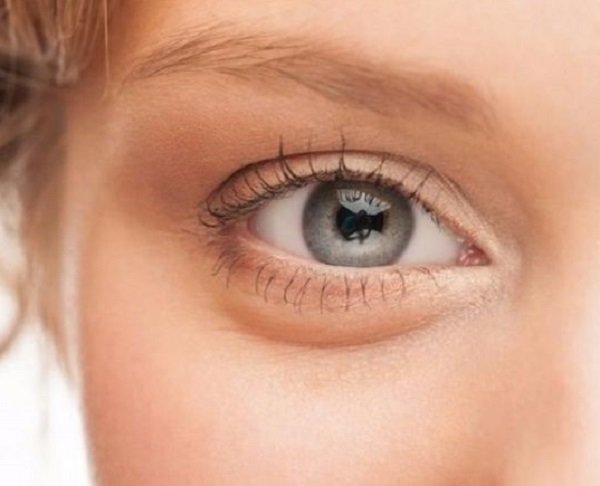 روش درمان ‌تیرگی ‌دور ‌چشم ‌چیست؟