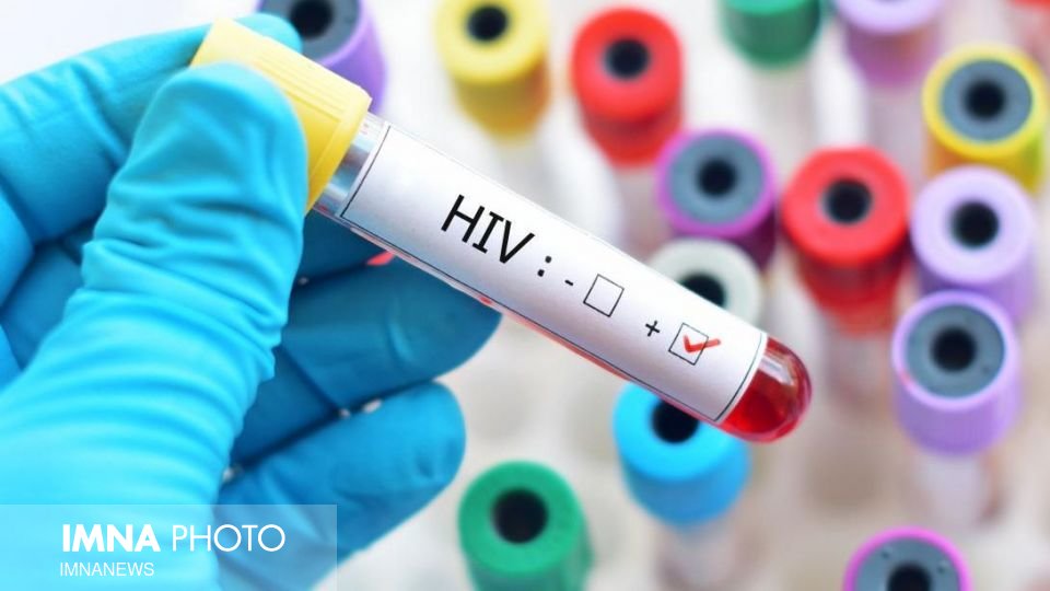 شناسایی ۱۵۱ بیمار مبتلا به اچ‌آی‌وی در منطقه کاشان/۶۸ درصد ابتلا از طریق تزریق مشترک