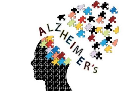 چرت‌زدن، معیاری برای تشخیص آلزایمر!