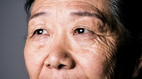  پیش‌بینی آلزایمر به کمک حرکات چشم