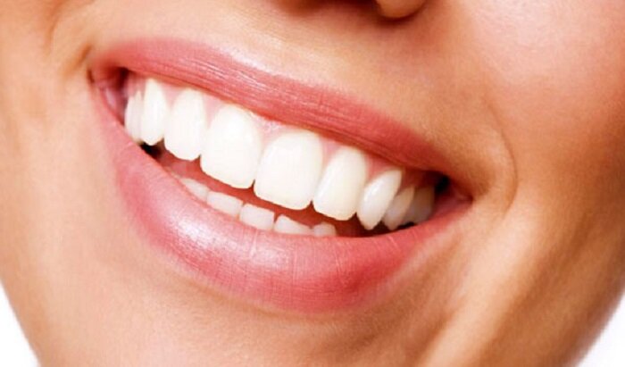 راز داشتن دندان‌های سفید چیست؟
