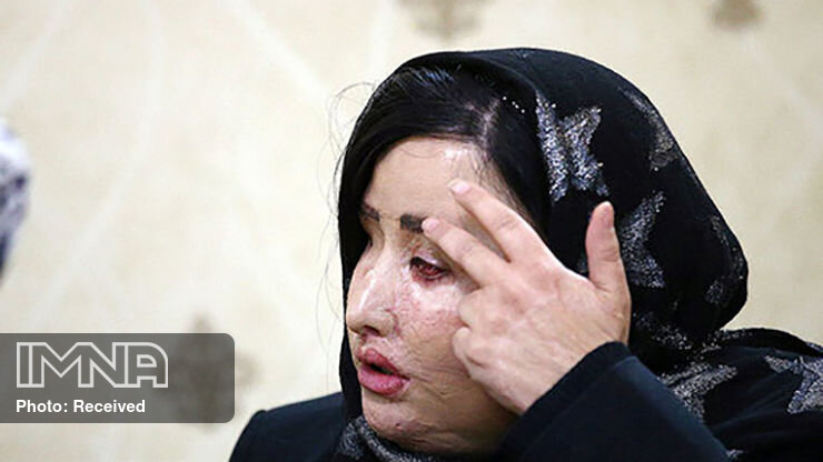 حضور یکی از قربانیان اسیدپاشی در شورای شهر اصفهان