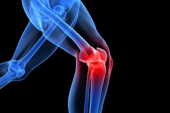 علائم آسیب‌های مفصل زانو چیست؟