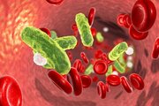 سپسیس (Septicemia) چیست و چه علائمی دارد؟