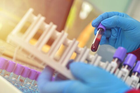 تلاش محققان برای تشخیص سرطان با استفاده از آزمایش خون