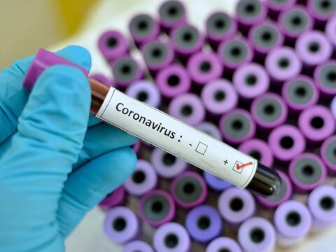 تشخیص ویروس کرونا در کمتر از ۱۵ دقیقه