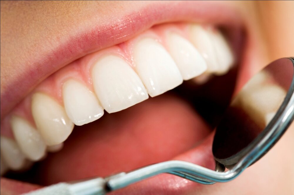 چرا دندان‌ها بعد از جرم گیری حساس می‌شوند؟