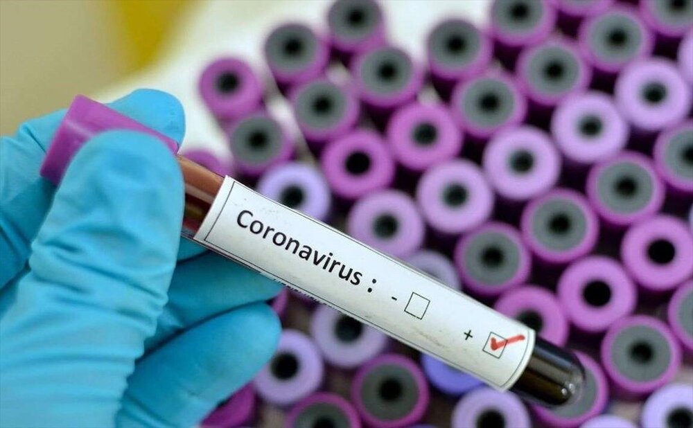 فهرست جدید آزمایشگاه‌های غیردولتی مجاز تشخیص "کرونا" اعلام شد