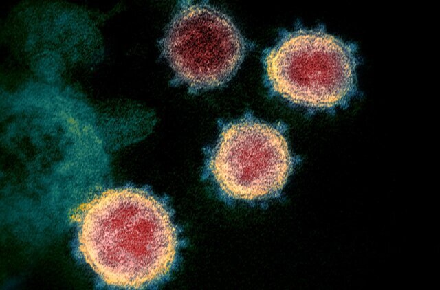چه عواملی عمر ویروس کرونا را کاهش می‌دهد؟