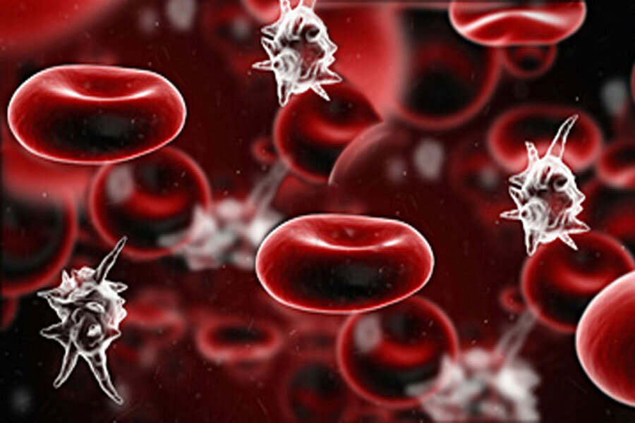 ارتباط بین عفونت خون و سرطان روده بزرگ چیست؟