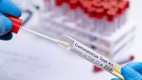 تست‌های روزانه برای شناسایی ویروس کرونا افزایش می‌یابد