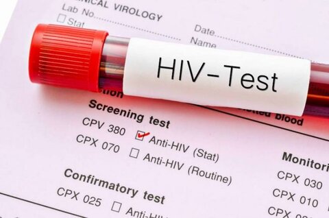 سرکوب اچ ای وی با یک روش جدید