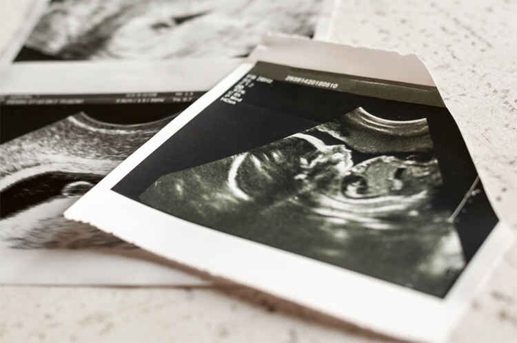 پیشنهاد سقط جنین توسط مادرشوهر