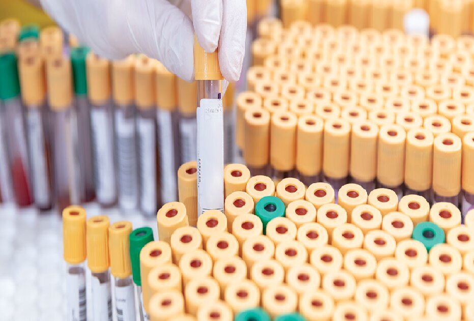 توزیع رایگان کیتهای تست کرونا در یونان