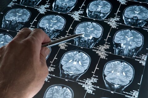 آزمایشگاه ملی نقشه ‌برداری مغز با دانشگاه دانمارک جنوبی همکاری می‌کند