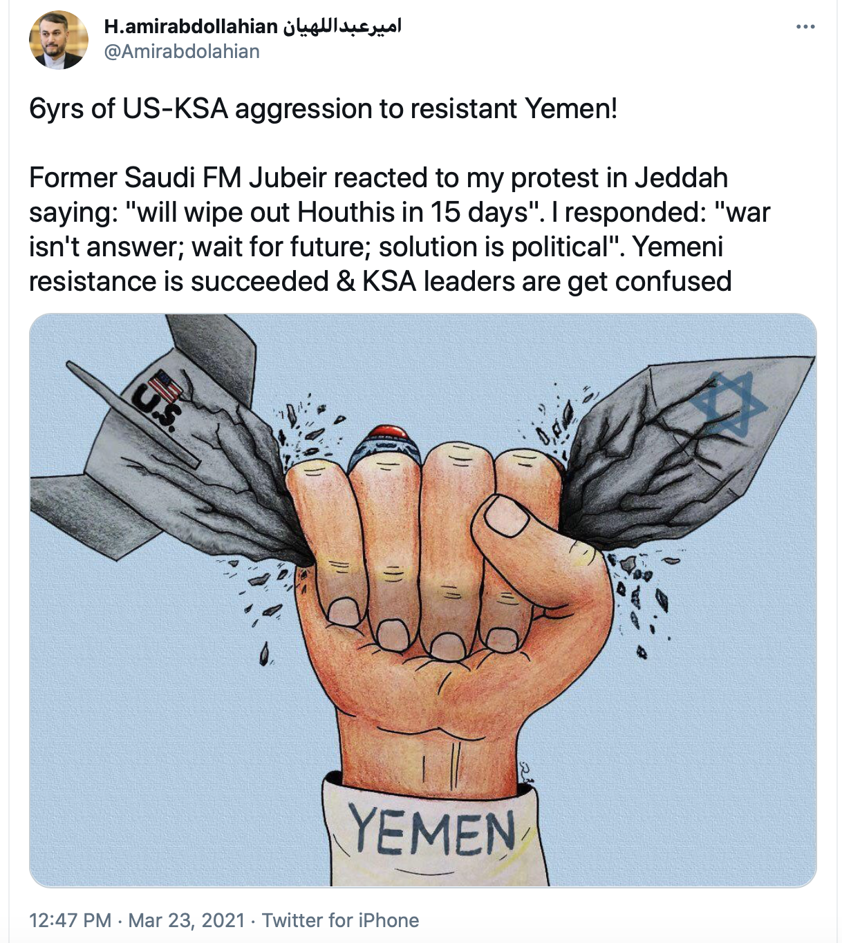 مقاومت یمن امروز پیروز و حاکمان سعودی به شدت گیج و مبهوت اند