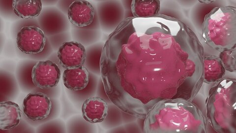 شناسایی زیرگروه‌های جدیدی از سرطان خون با کمک یک مدل محاسباتی