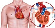 روش های درمان بیماری قلبی