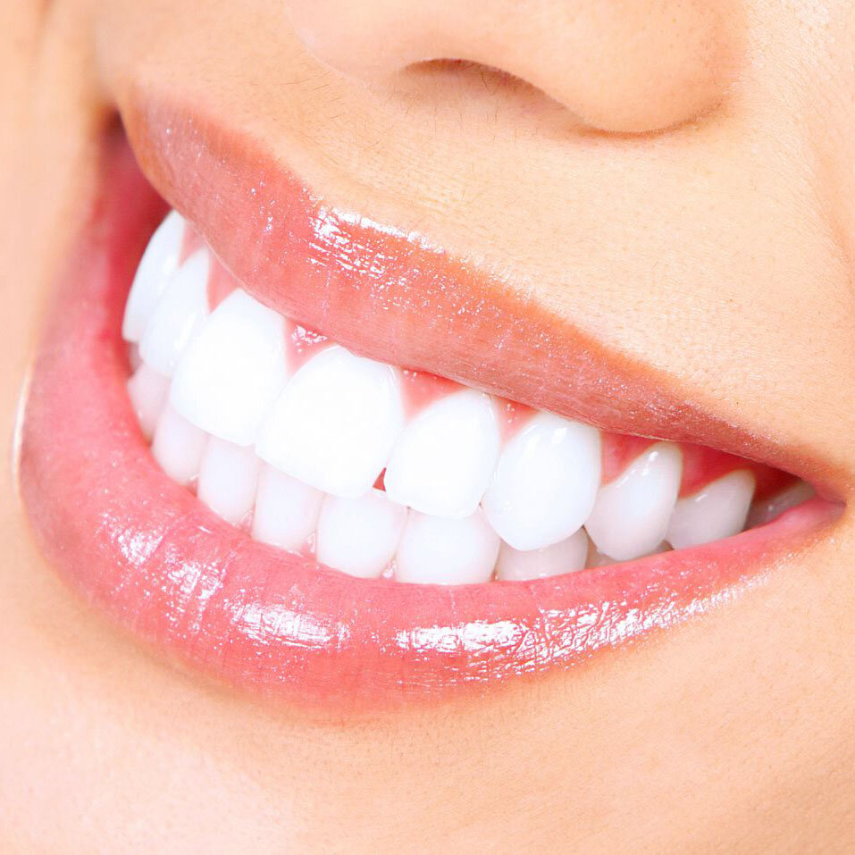 آیا سفید کردن دندان با زردچوبه امکان پذیر است؟