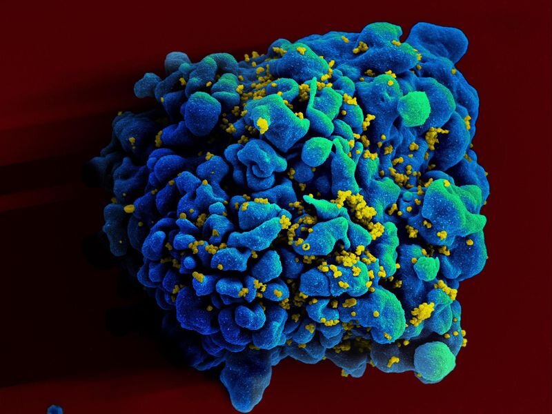 نتایج امیدوارکننده آزمایش واکسن mRNA علیه ایدز