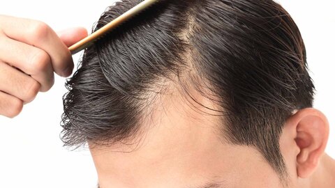 تأثیر عجیب مصرف امگا ۳ در رشد موها
