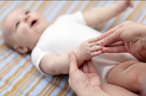 علت و روش درمان "فلج ارب" در نوزادان