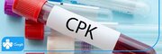 آسیب‌های بدن خود را با آزمایش CPK تشخیص دهید!