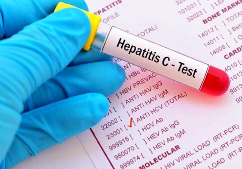 شناسایی ۱۵۰ بیمار مبتلا به هپاتیت B و C در کاشان و آران و بیدگل