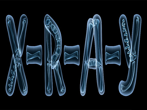 تشخیص سریع کرونا با کمک اشعه ایکس