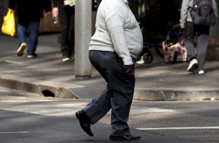 چه ارتباطی بین چاقی و مرگ‌ومیر ناشی از کرونا وجود دارد؟