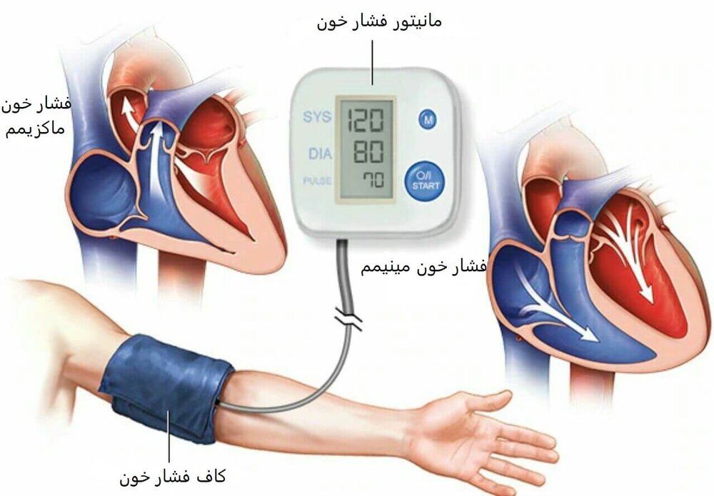 فشار خون بالا چیست؟+ علائم و درمان